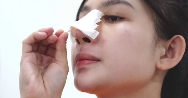 Chăm sóc vết thương sau khi nâng mũi
